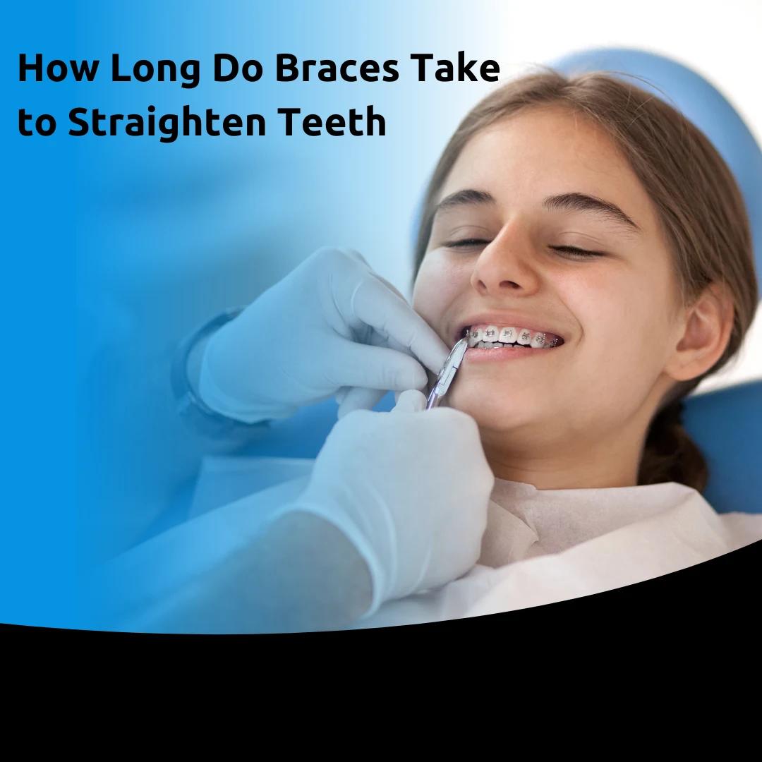 How Long Do Braces Take to Straighten Teeth? Learn More!