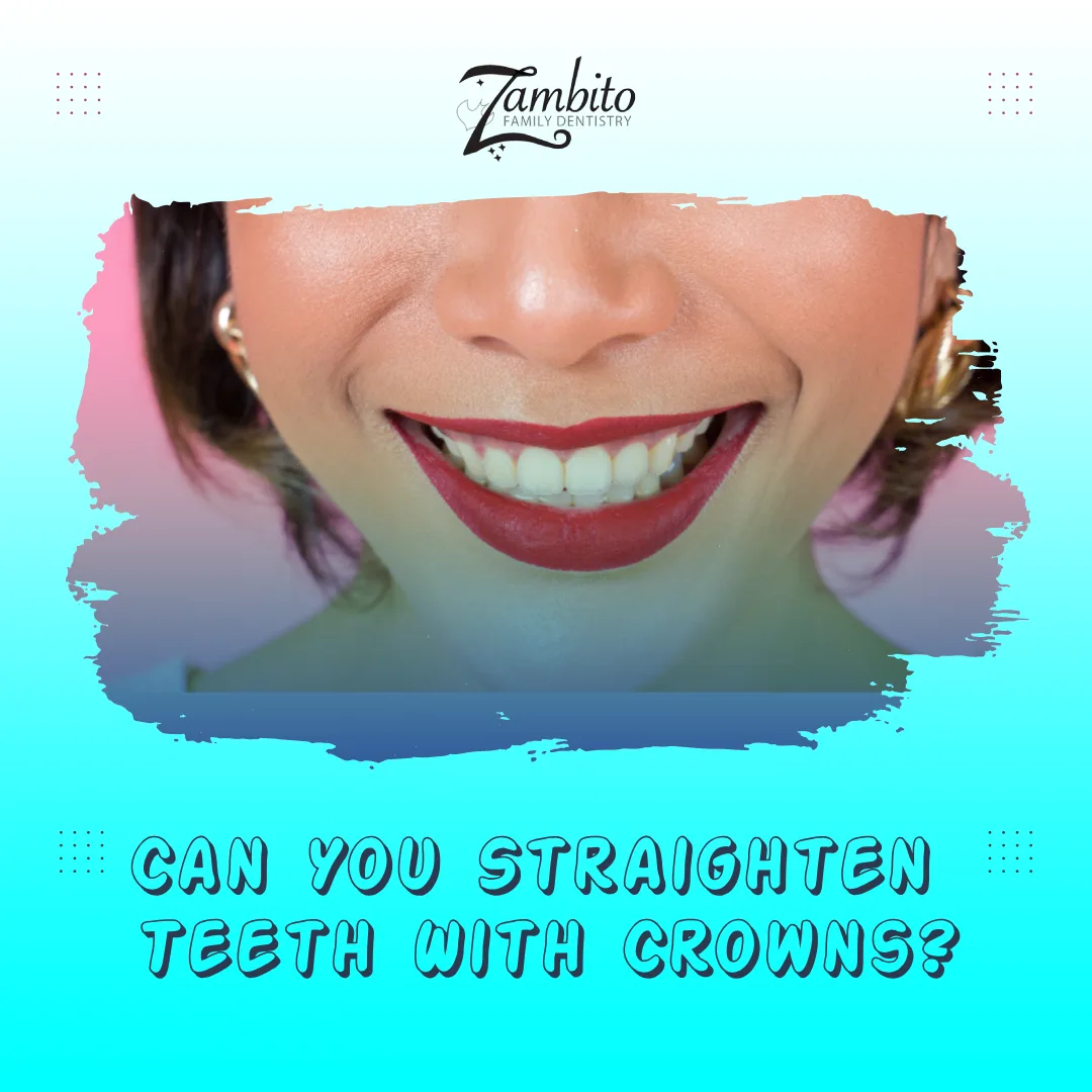 Can You Straighten Teeth With Crowns? A Dentist's Guide