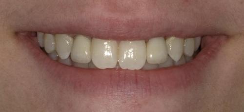 After